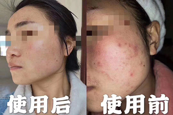 精油能喝嗎？不是所有精油都能喝-歐泉生化